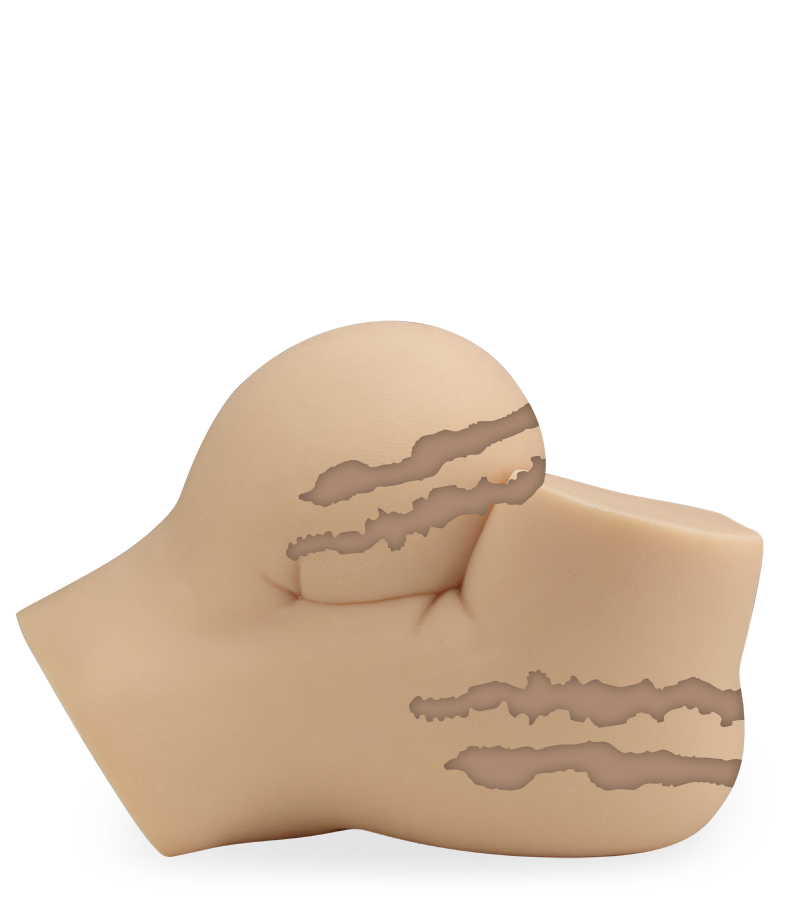 FF threesome masturbator 12.50 lb